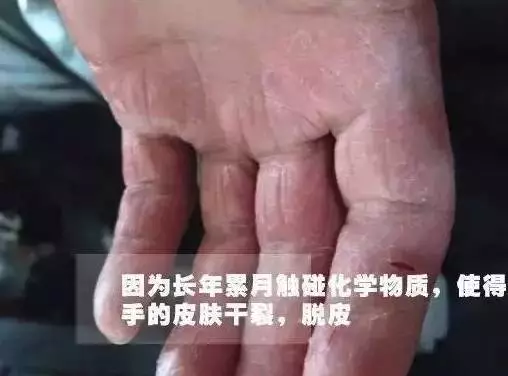 CQ9电子 CQ9传奇电子纺织厂倒班工人的辛酸你们是纺织业的最可爱的人(图4)